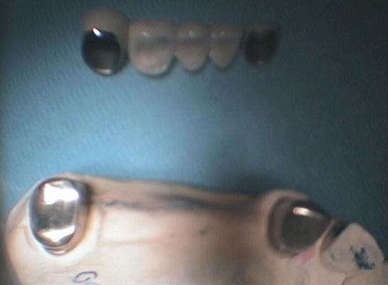 ΤΗΛΕΣΚΟΠΙΚΗ ΓΕΦΥΡΑ 3